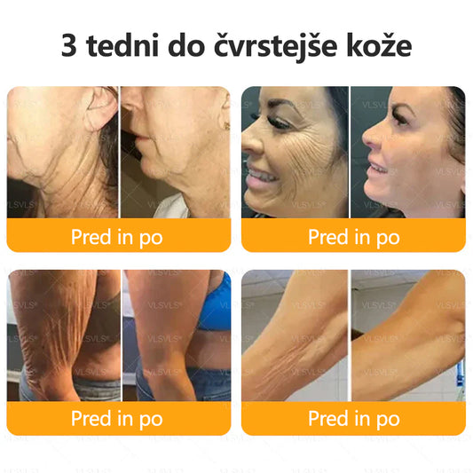 CleraNaure® krema za obnovo kože s čebeljim strupom