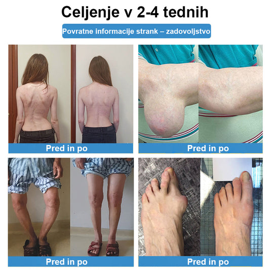 CleraNaure® Nano-mikroiglični obliž za sklepe