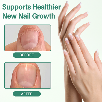 CleraNaure® proti glivicam nohtov – penetracijski serum v pisalu