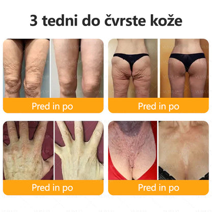 CleraNaure® krema za obnovo kože s čebeljim strupom