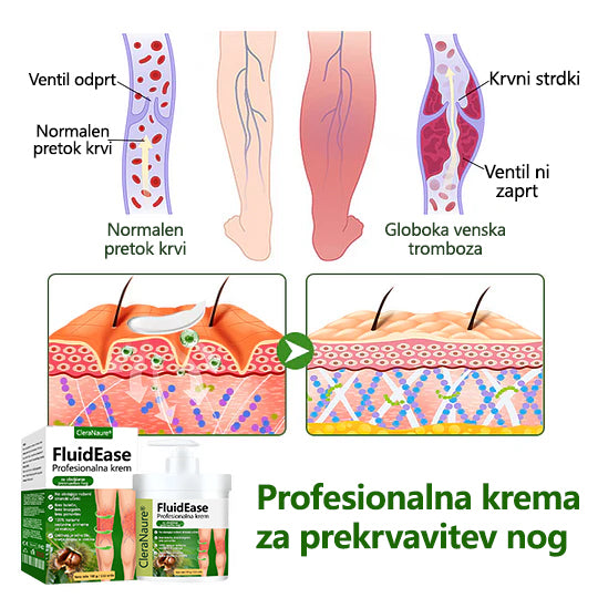 🌿 Poslovite se od otečenih, bolečih nog – CleraNaure® FluidEase Profesionalna krema za izboljšanje prekrvavitve nog prinaša pravo olajšanje! ✨🦵