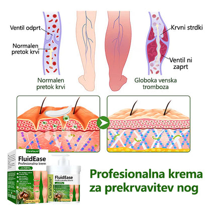🌿 Poslovite se od otečenih, bolečih nog – CleraNaure® FluidEase Profesionalna krema za izboljšanje prekrvavitve nog prinaša pravo olajšanje! ✨🦵