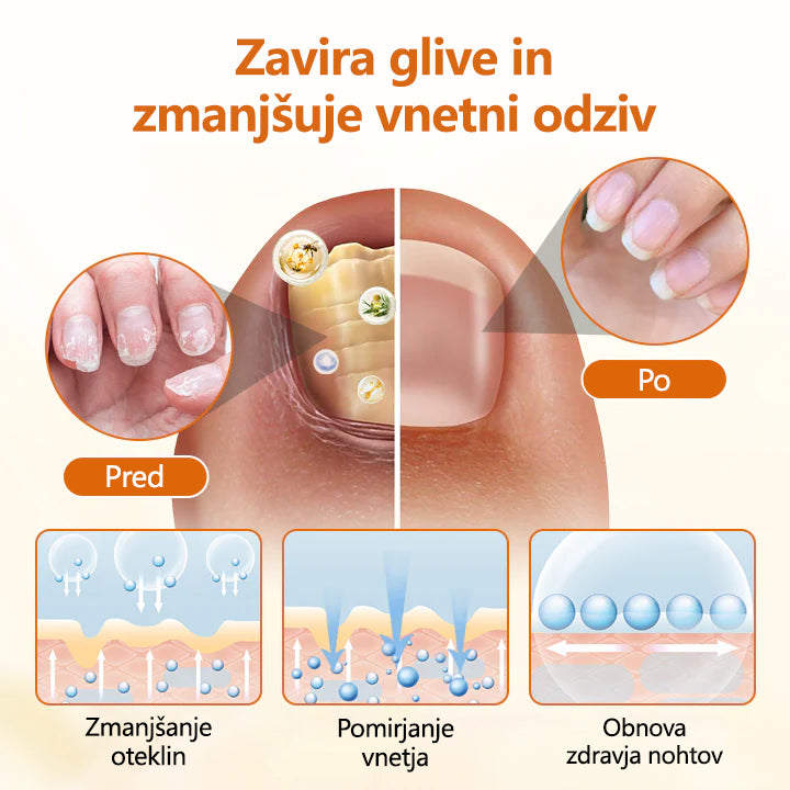 CleraNaure® FungiBee Napreden sprej za obnovo nohtov