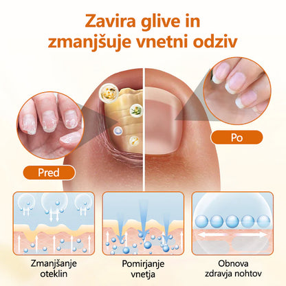 CleraNaure® FungiBee Napreden sprej za obnovo nohtov