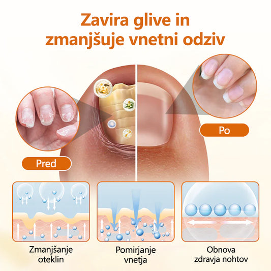 CleraNaure® FungiBee Napreden sprej za obnovo nohtov