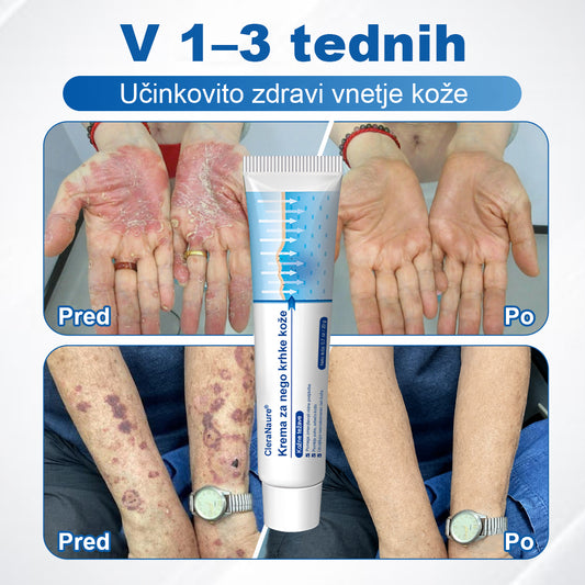 CleraNaure® krema za občutljivo in krhko kožo 🌿 Večnamenska poprava za podplutbe, suhost in madeže