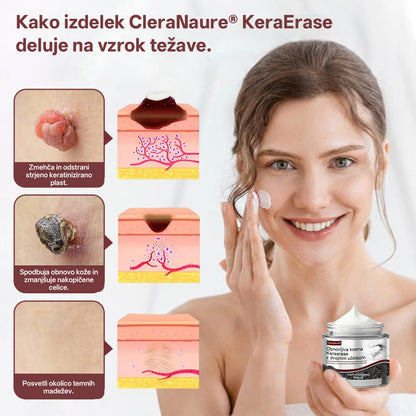 CleraNaure® OryzaClear – Močna krema s črnim rižem za kožne izrastke in izbokline · Nežna rastlinska formula za mehčanje