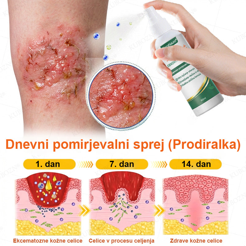 CleraNaure® Eczema Day & Night Repair System – 100-odstotno brezsteroidni dvojček za lajšanje hudega srbenja, rdečine in prekinjene kože (v posebni ponudbi)