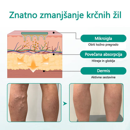 CleraNaure® LegRenew obliž za krčne žile