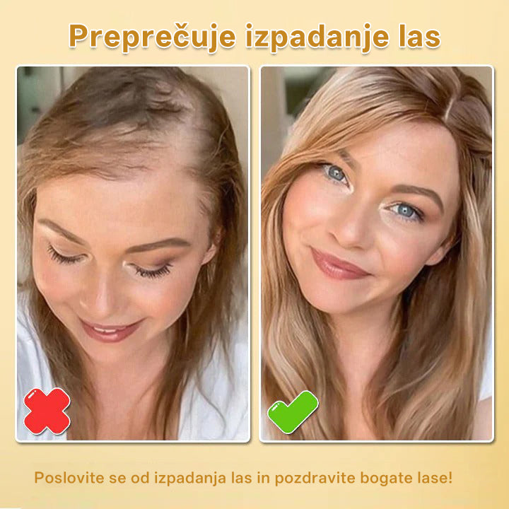 CleraNaure® Biotin Hair Growth Essence Spray (Nova formula)