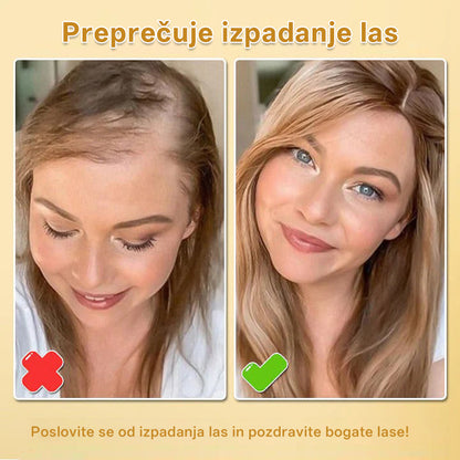 CleraNaure® Biotin Hair Growth Essence Spray (Nova formula)