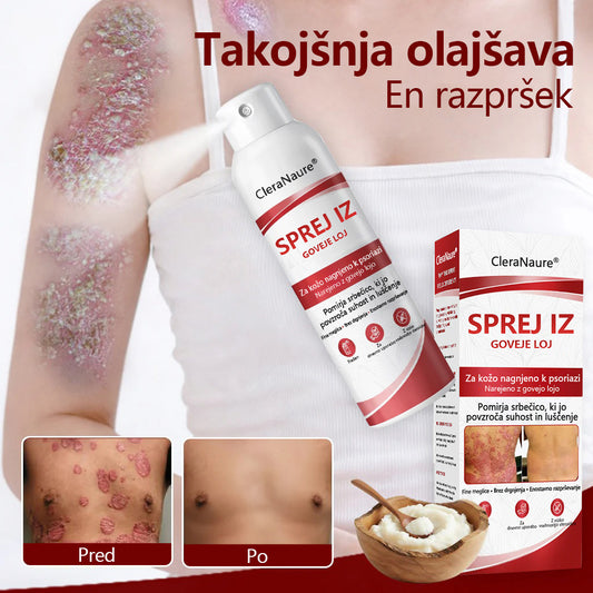 CleraNaure® Beef Tallow Spray za Srbečo in Luščečo Kožo Pri Psoriazi