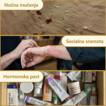 CleraNature® PsorCure Ciljno lajšanje z voskom čebel