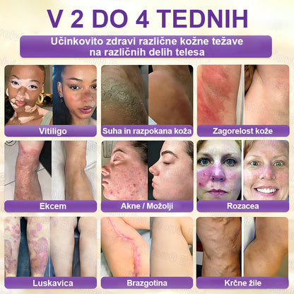 CleraNaure® Biotin 10-v-1 krema za obnovo kože