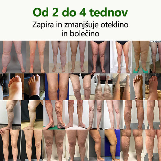 ⭐ Poslovite se od otečenih, bolečih nog – CleraNaure® FluidEase Profesionalna krema za izboljšanje prekrvavitve nog prinaša pravo olajšanje! ✨🦵🌿