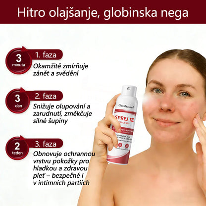 CleraNaure® Beef Tallow Spray za Srbečo in Luščečo Kožo Pri Psoriazi