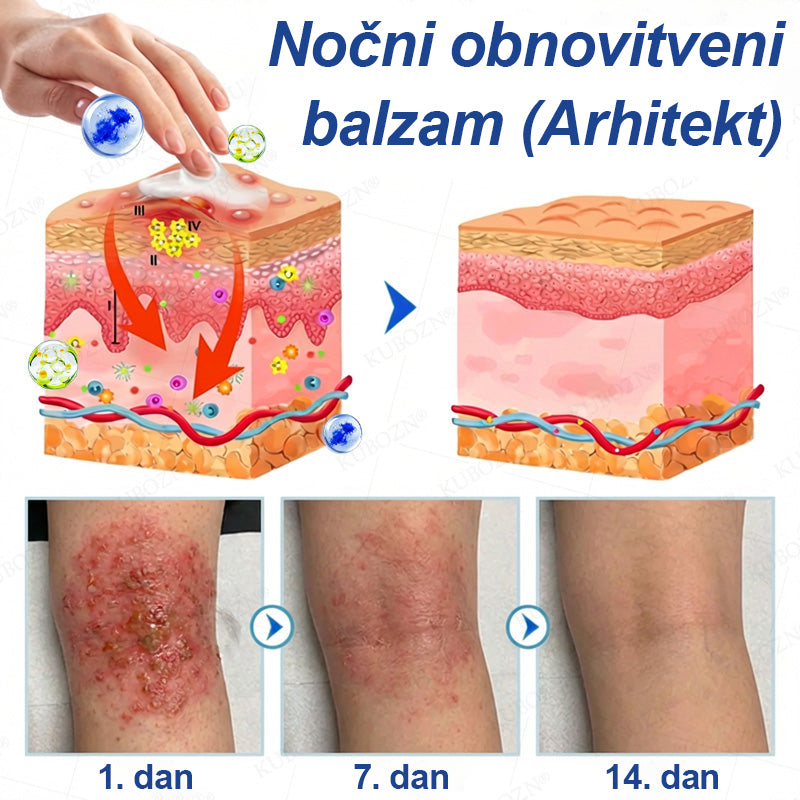 CleraNaure® Eczema Day & Night Repair System – 100-odstotno brezsteroidni dvojček za lajšanje hudega srbenja, rdečine in prekinjene kože (v posebni ponudbi)