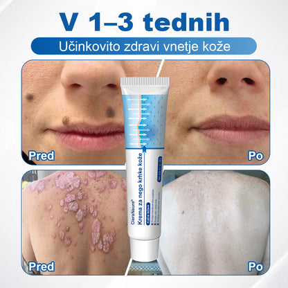 CleraNaure® krema za občutljivo in krhko kožo 🌿 Večnamenska poprava za podplutbe, suhost in madeže