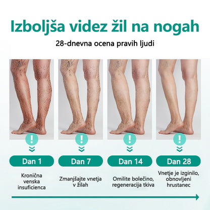 CleraNaure® LegRenew obliž za krčne žile