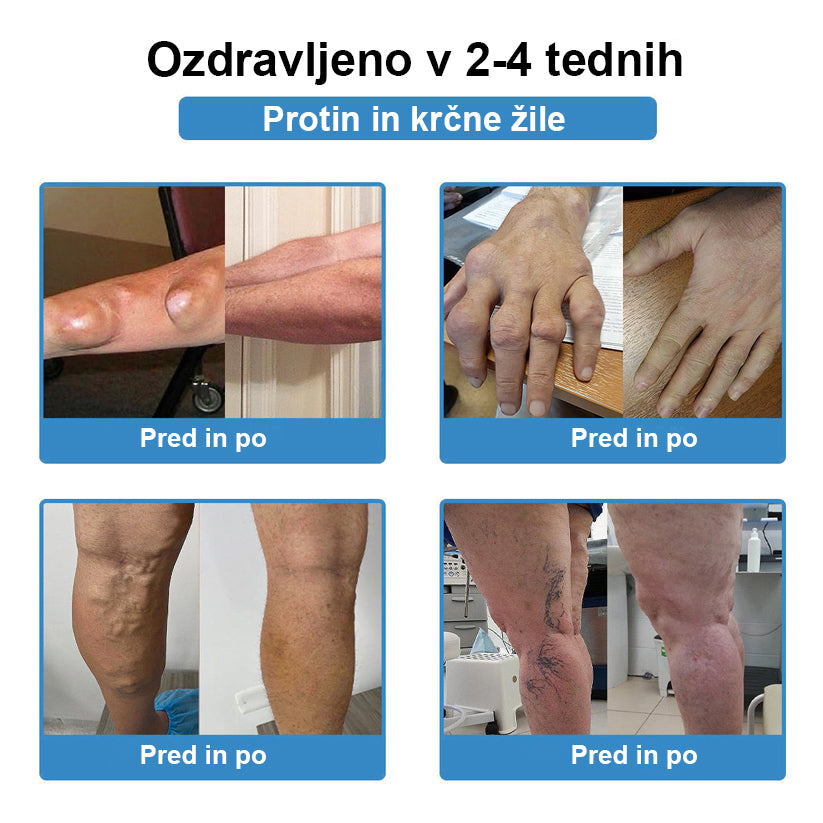 CleraNaure® Nano-mikroiglični obliž za sklepe