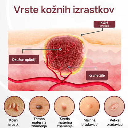 CleraNaure® OryzaClear – Močna krema s črnim rižem za kožne izrastke in izbokline · Nežna rastlinska formula za mehčanje