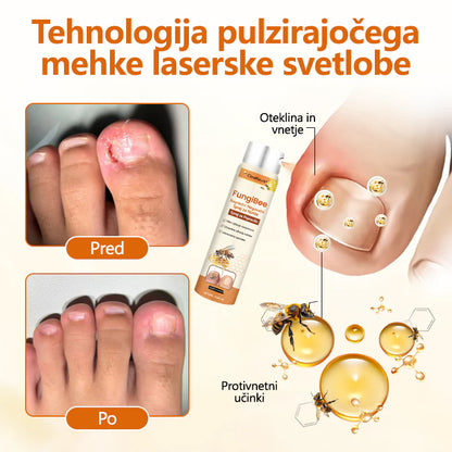 CleraNaure® FungiBee Napreden sprej za obnovo nohtov