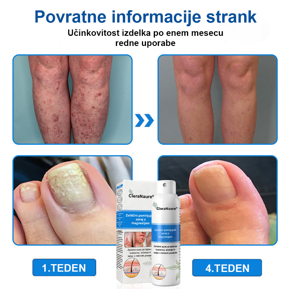 CleraNature® Magnezijev Sprej – Hitro Olajšanje za Srbečo, Rdečo in Občutljivo Kožo (tudi na intimnih predelih)