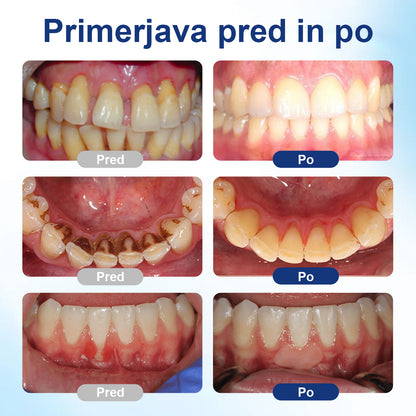 COLTURE® Kapljice za obnovo dlesni GumHoney