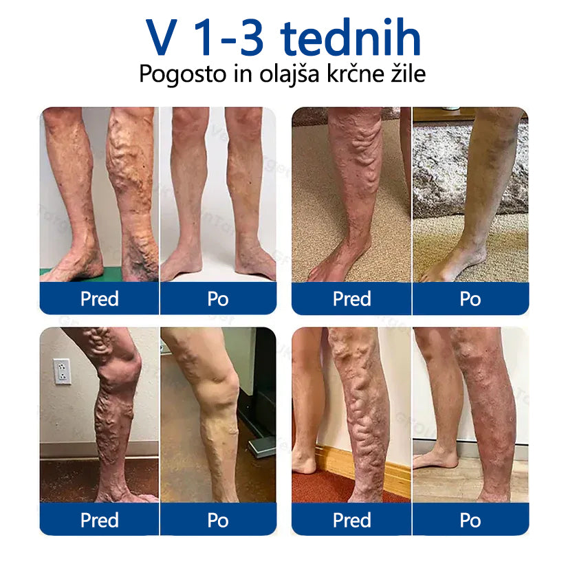 Healrize® VeinTarget mikroiglični obliž