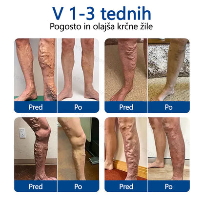 Healrize® VeinTarget mikroiglični obliž