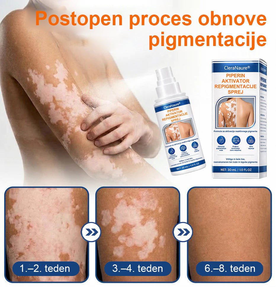 CleraNaure® Piperine Repigment Aktivator Sprej, ki aktivira neaktivne pigmentne celice in povrne naravno barvo kože.