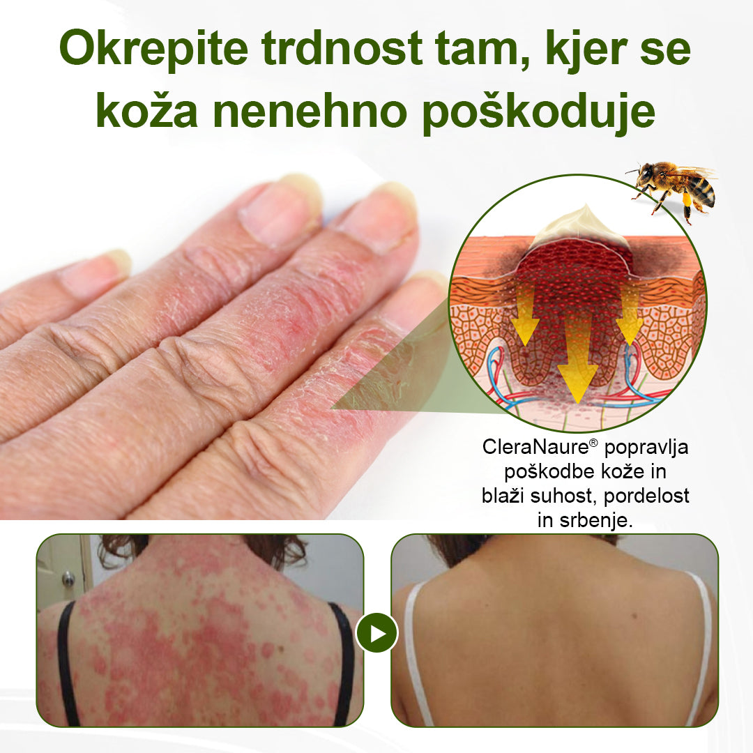 CleraNaure® BeePeptide RootSoft DualRelief Krema