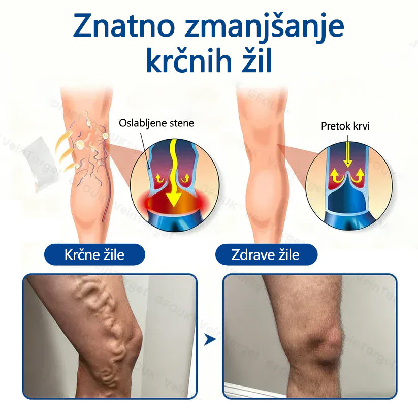 Healrize® VeinTarget mikroiglični obliž