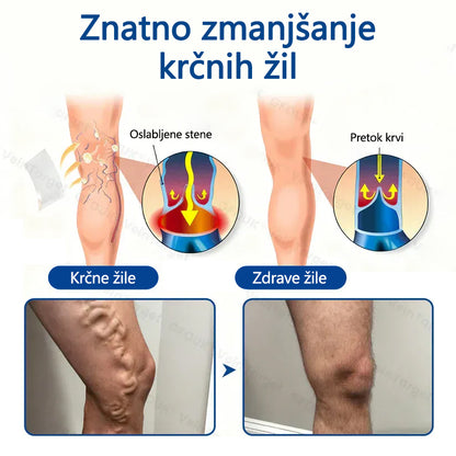 Healrize® VeinTarget mikroiglični obliž