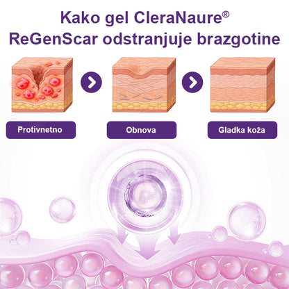 CleraNaure® ReGenScar Gel za brazgotine z matičnimi celicami