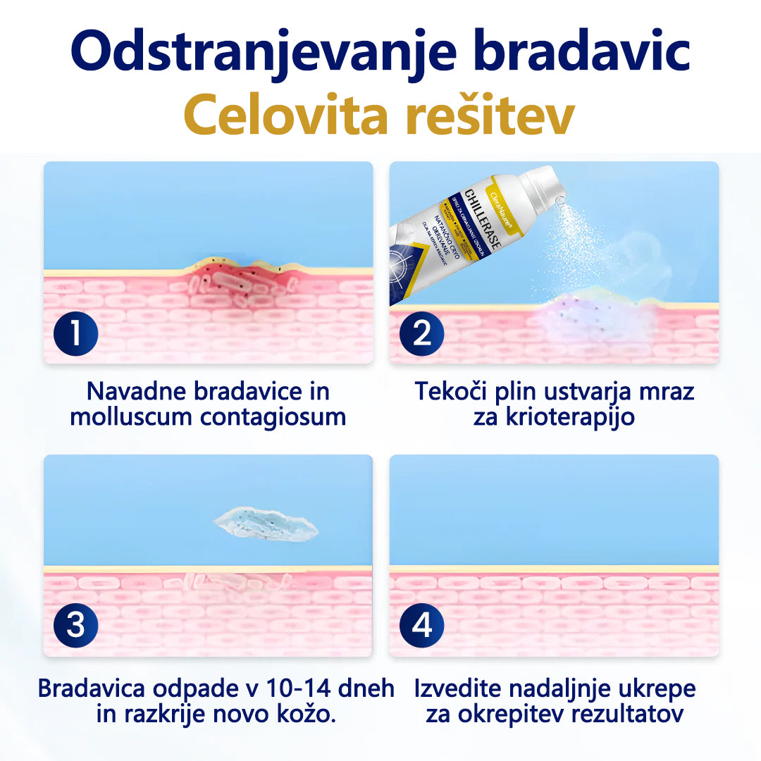 CleraNaure® ChillErase Sprej za pomlajevanje izboklin