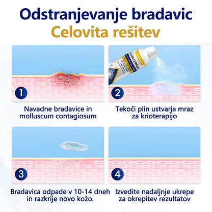 CleraNaure® ChillErase Sprej za pomlajevanje izboklin