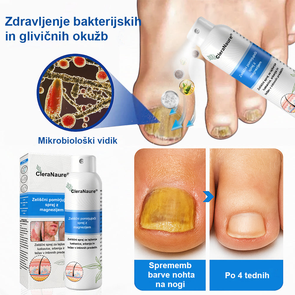 CleraNature® Magnezijev Sprej – Hitro Olajšanje za Srbečo, Rdečo in Občutljivo Kožo (tudi na intimnih predelih)