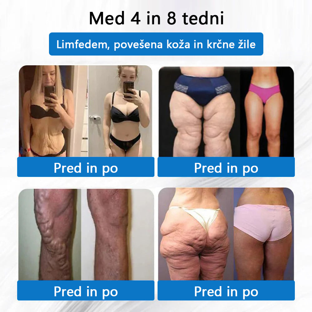 ⚜️CleraNaure® 7‑v‑1 metabolični in oblikovalni prilepek (tehnologija mikrodifuzije, 24-urni učinek) ✨ Obliž za uravnavanje telesne teže, apetita, energije in presnove glukoze.