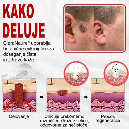 CleraNature® WartAway Pro obliži