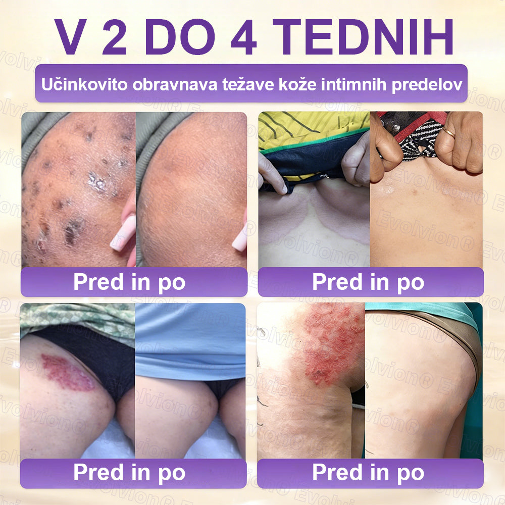 CleraNaure® Biotin 10-v-1 krema za obnovo kože