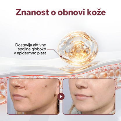 CleraNaure® OryzaClear – Močna krema s črnim rižem za kožne izrastke in izbokline · Nežna rastlinska formula za mehčanje