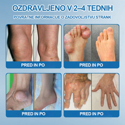 ✨Zadnji dan promocije 80% POPUSTA | 🇸🇮 CleraNaure® BPC-157 Kremo za zdravljenje sklepov🦴 Zdravljenje artritisa, nevropatije, revmatizma, športnih poškodb in še več