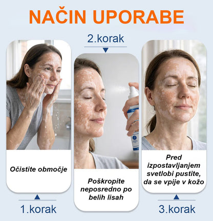 CleraNaure® Piperine Repigment Aktivator Sprej, ki aktivira neaktivne pigmentne celice in povrne naravno barvo kože.