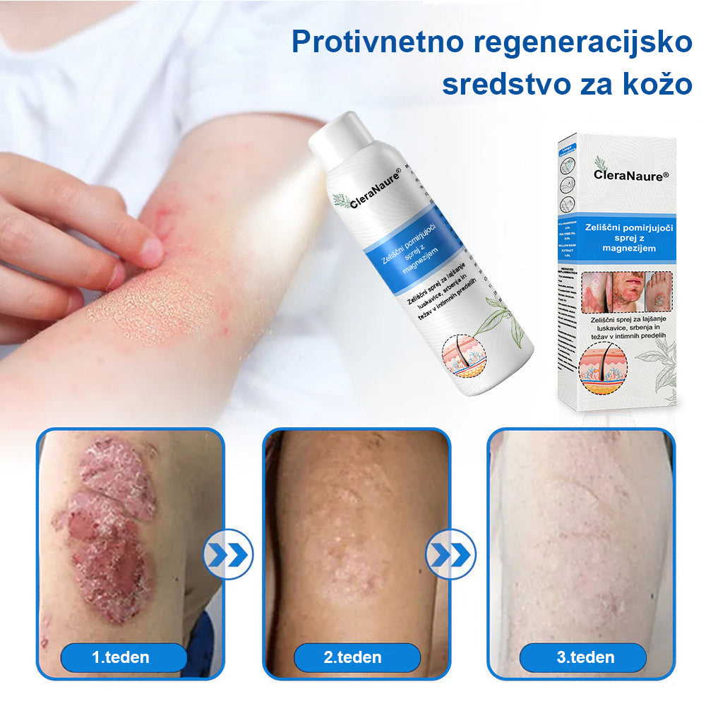 CleraNature® Magnezijev Sprej – Hitro Olajšanje za Srbečo, Rdečo in Občutljivo Kožo (tudi na intimnih predelih)