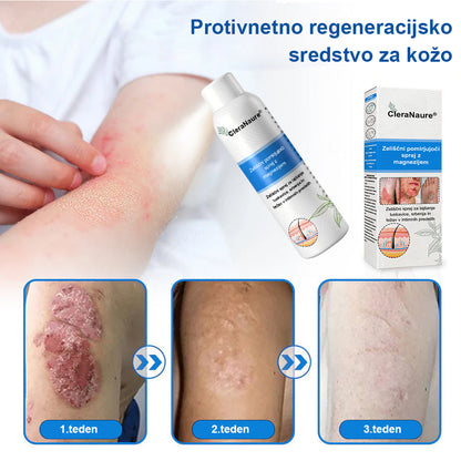 CleraNature® Magnezijev Sprej – Hitro Olajšanje za Srbečo, Rdečo in Občutljivo Kožo (tudi na intimnih predelih)