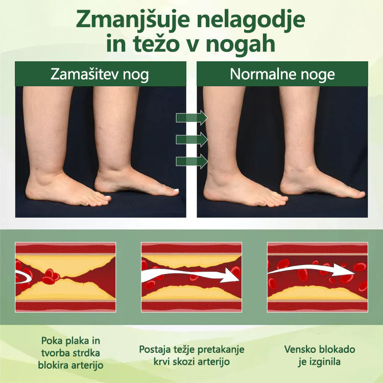 🌿 Poslovite se od otečenih, bolečih nog – CleraNaure® FluidEase Profesionalna krema za izboljšanje prekrvavitve nog prinaša pravo olajšanje! ✨🦵