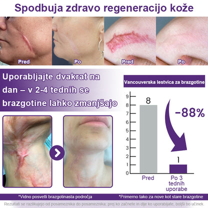 CleraNaure® ReGenScar Gel za brazgotine z matičnimi celicami