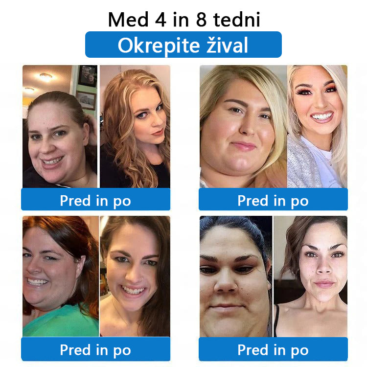 ⚜️CleraNaure® 7‑v‑1 metabolični in oblikovalni prilepek (tehnologija mikrodifuzije, 24-urni učinek) ✨ Obliž za uravnavanje telesne teže, apetita, energije in presnove glukoze.