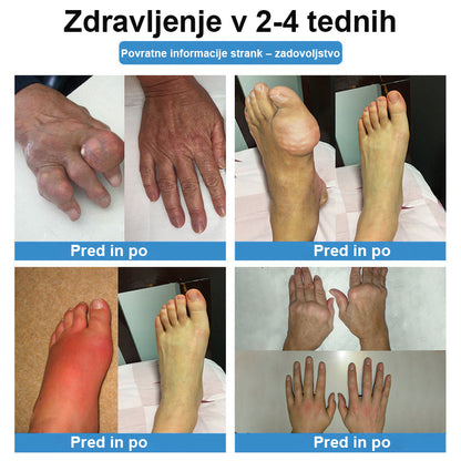 CleraNaure® Nano-mikroiglični obliž za sklepe